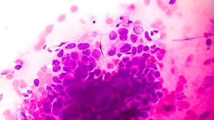 Un nou vaccin împotriva cancerului a blocat tumorile la șoareci