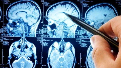 Oamenii de știință descoperă un circuit cerebral care poate opri durerea cronică