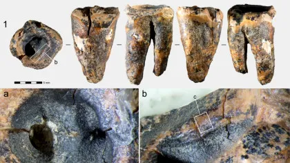 Unde practicau neanderthalienii stomatologia acum 60.000 de ani?