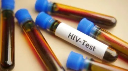 Un nou medicament ar putea ține HIV sub control timp de doi ani