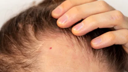 Un studiu arată modul surprinzător în care crește părul