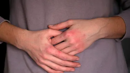 Inflamația din organism ar putea influența sănătatea mintală?