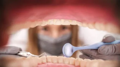 Test de cultură generală. Cât de mulți dinți poate avea un om?