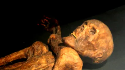 Ötzi Omul Ghețurilor era purtătorul celui mai răspândit virus din zilele noastre