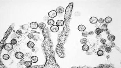 Focar mortal de hantavirus pe un vas de croazieră din Atlantic