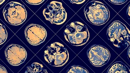 Un nou studiu schimbă tot ce știam despre modul în care funcționează memoria