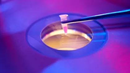 Tot mai multe femei apelează la congelarea ovocitelor. Dar ce înseamnă asta?