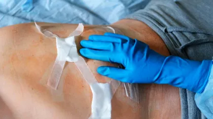 O boală care până cum a fost extrem de rară a început să fie detectată la tineri