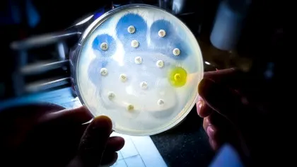 Decesele cauzate de „superbacterii” rezistente la antibiotice au crescut cu 17% în Marea Britanie