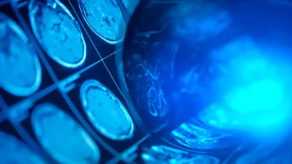 O singură scanare cerebrală poate dezvălui cât de repede îmbătrânești