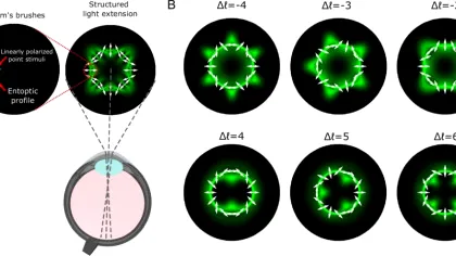Optica cuantică ar putea transforma un fenomen vizual rar într-un test de vedere