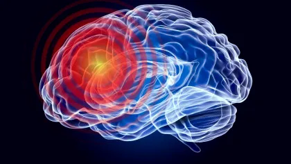 A fost descoperită o tulburare neurologică necunoscută până acum