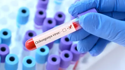 Nivel fără precedent de infecții cu chikungunya în Franța