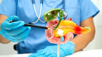 Cercetătorii brazilieni au făcut o descoperire importantă în lupta cu unul dintre cele mai agresive tipuri de cancer