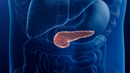 Cancerul pancreatic, depistat înainte să fie vizibil la tomografie. Ce aduce nou inteligența artificială