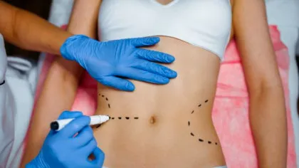 BANCUL ZILEI. BULĂ: – Mi-a cerut soţia 2000 de euro pentru o operație