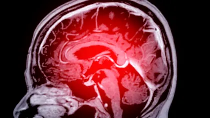 Cum să reduci la jumătate riscul de demență? 14 obiceiuri confirmate de experți!