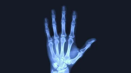 Test de cultură generală. Cine a descoperit razele X?