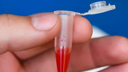 Viitoarele tratamente pentru slăbit ar putea fi create din sângele de piton