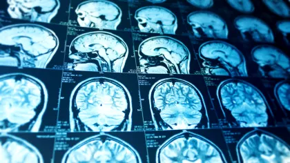 Mii de scanări cerebrale dezvăluie o consecință îngrijorătoare a muncii în ture de noapte