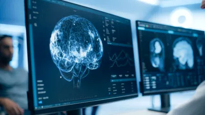 Un nou studiu arată efectele nefaste ale zborului spațial asupra creierului