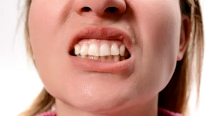 Ce se întâmplă cu sistemul imunitar atunci când ne facem un implant dentar?