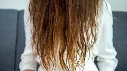 De ce tot mai multe femei solicită transplant de păr?