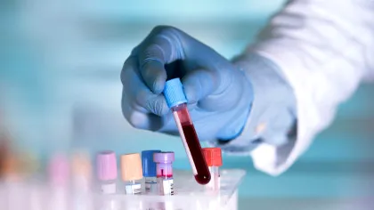 Un nou test de sânge poate depista cancerul cu trei ani înainte de diagnostic