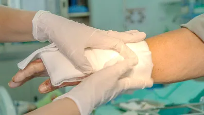 Un dispozitiv bazat pe Inteligență Artificială vindecă rănile cu 25% mai rapid decât tratamentul obișnuit