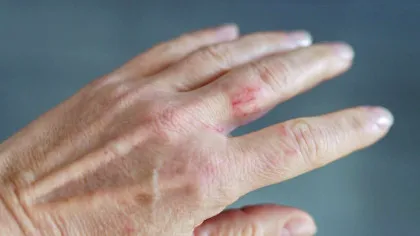 Mâinile nu mint? Noua obsesie din industria frumuseții mută atenția dincolo de pielea feței