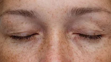 Paradoxul pistruilor: De la „semne ale diavolului” la cel mai dorit trend de beauty. Ce spune știința despre petele care fascinează lumea?