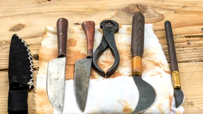 Practici dentare bizare din istorie: de la „viermii dinților” la pasta din șoareci