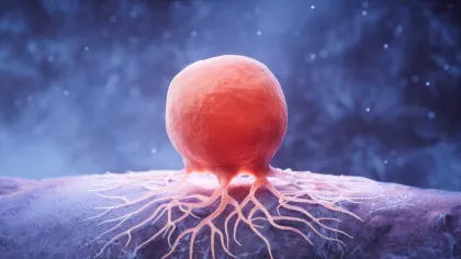 Un nou studiu amplu identifică noi ținte terapeutice potențiale pentru cel mai frecvent tip de cancer colorectal