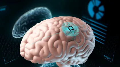 Un implant mai mic decât un bob de sare îți poate citi creierul în timp real