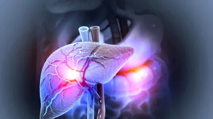 Boala ficatului gras, în creștere: 1,8 miliarde de persoane ar putea fi afectate până în 2050