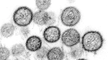 OMS dă asigurări că focarul de hantavirus de pe vasul de croazieră „nu este începutul unei noi pandemii”
