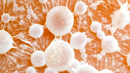 Oamenii de știință au descoperit două gene care ar putea opri răspândirea cancerului