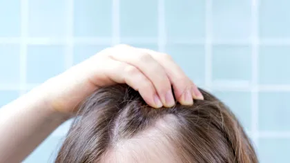 Un medicament comun pentru artrită ar putea stimula regenerarea părului la pacienții cu alopecie