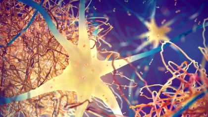 Cancerul ar putea emite semnale care protejează creierul împotriva bolii Alzheimer