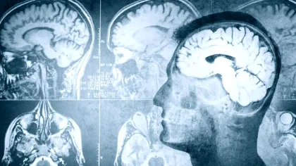 O moleculă anti-îmbătrânire ar putea ajuta la restabilirea memoriei în boala Alzheimer